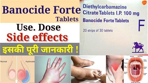 Banocide Forte Tablet Benefits Dose Side Effects Review In Hindi