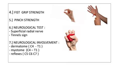 De Quervain Syndrome Ppt