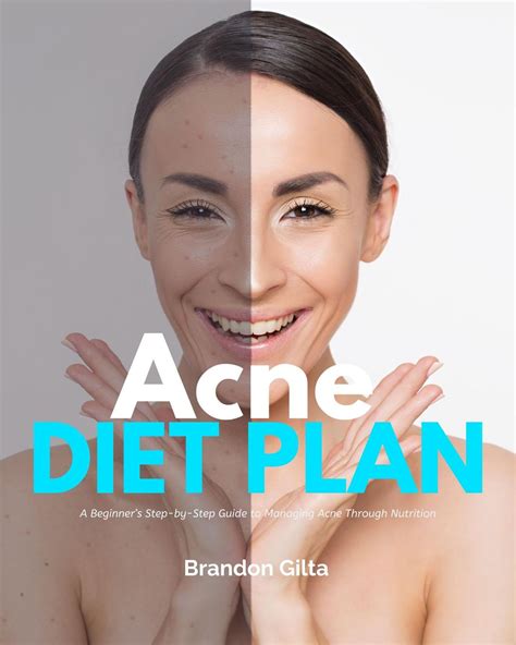 Acne Diet Plan eBook by Brandon Gilta - EPUB Book | Rakuten Kobo 9798869134134