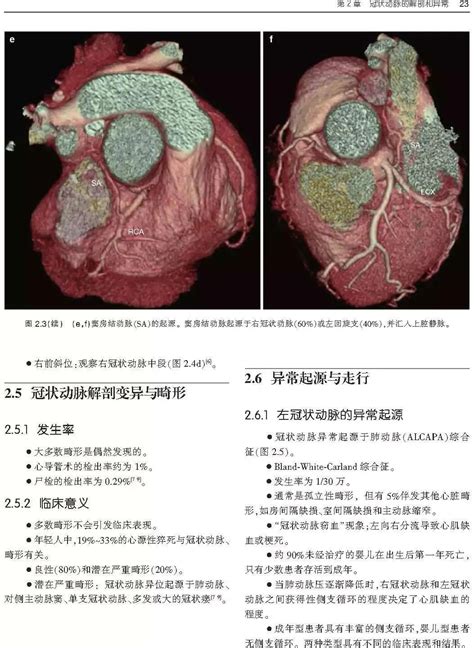 新书首发：一本心脏ct和mri影像学临床实用参考书，为心脏疾病诊断治疗提供新的方法！ 好医术文章 好医术 赋能医生守护生命