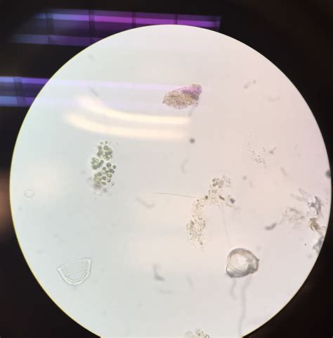 Biol213 Plants One Mystery Pond Water Organisms By Group Dcmc