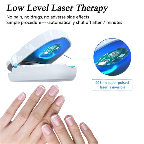 Kts Nail Fungus Laser Therapy Device Nm Nm Fungal Nail Treatment