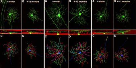 Retinal Ganglion Cell - Assignment Point