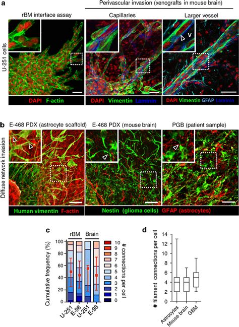 Validation Of In Vitro Assays By Glioma Invasion In Murine And Human