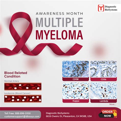 Multiple Myeloma Awareness Month Diagnostic Biosystems Advanced