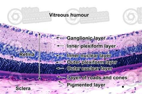 Mammal. Eye. Transverse section. 250X - Mammals - Mammals - Sensory ...