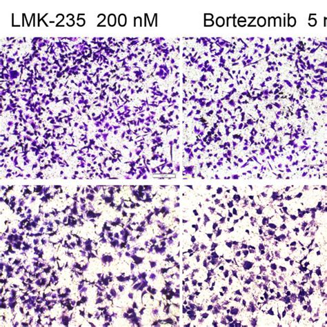 Lmk Synergizes With Bortezomib In Bc Cells F Mda Mb And