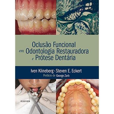 Oclusão Funcional em Odontologia Restauradora e Prótese Cartonado