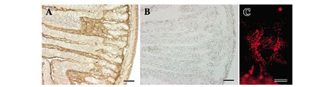 Localization Of P2Y1 In Rat Duodenum And In Cultured Subepithelial