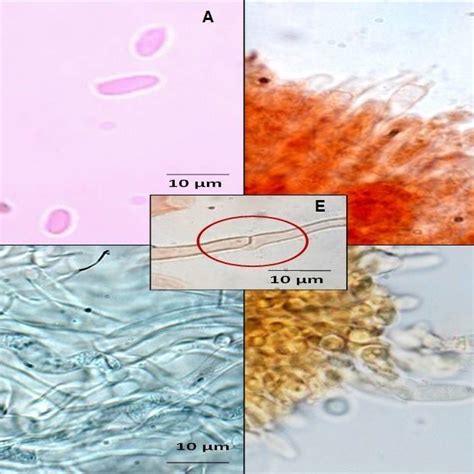 Light microscope photographs A. Basidiospores, B. Basidia, C. Pileus ...