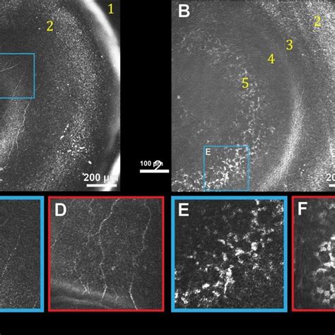 In Vivo Human Corneal Images Of Mid And Posterior Stroma Obtained With