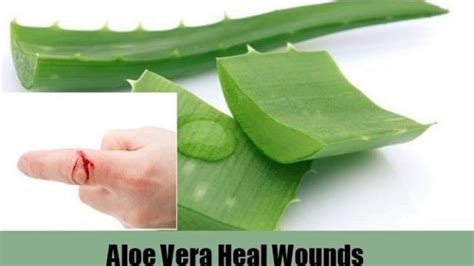 Speed Recovery Of Wounds Possible With Aloe Vera How To Use Youtube