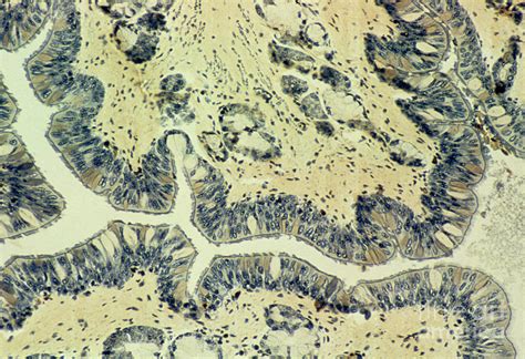 Light Micrograph Of Human Tracheal Epithelium Photograph By Astrid