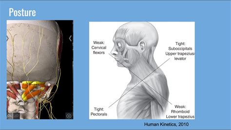 Preventing Shoulder Injuries A Physical Therapy Approach Youtube