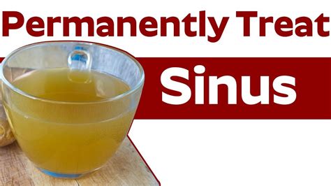 Best Home Remedies For Sinus Permanently Treat My Sinus At Home Youtube