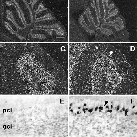 Detection Of Transgene Expression In Purkinje Cells By In Situ