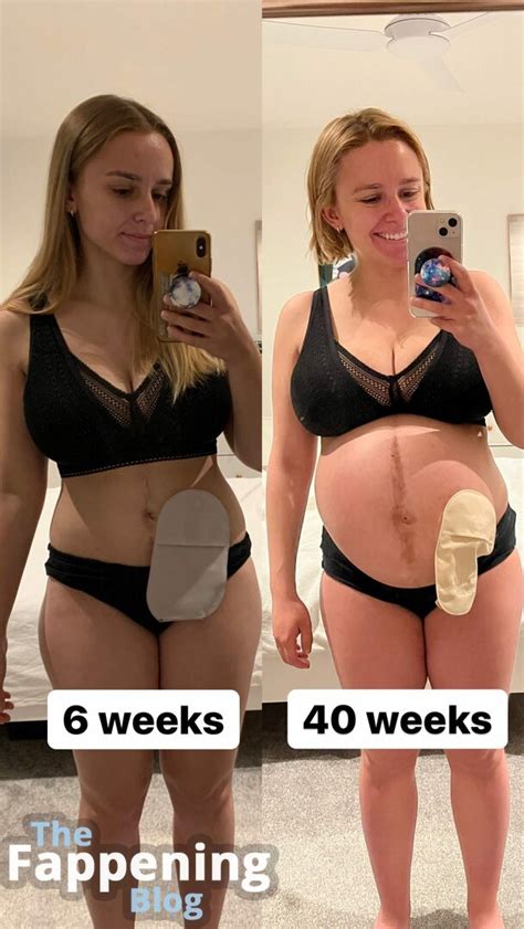 Hannah Witton Hannahwitton Nude Leaks Photo 25 TheFappening