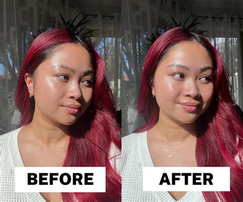 Face Ice Roller Before And After at Sam Hamby blog