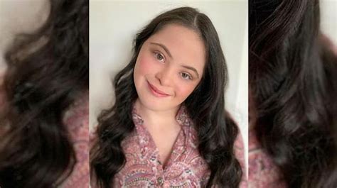 Ellie Model Down Syndrome Jadi Model Vogue Dan Gucci Beauty