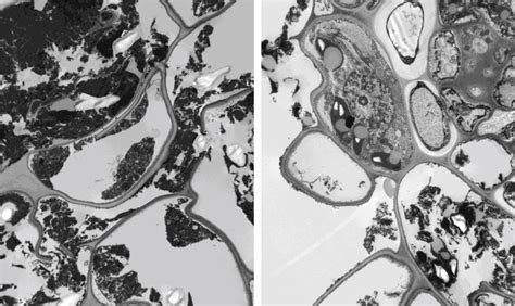 Transmission Electron Micrographs Of Yellow Halo Regions Of