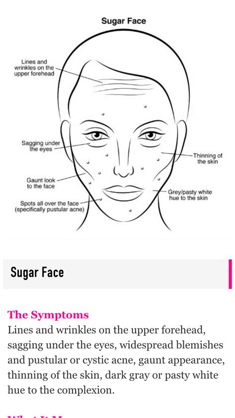 Sugar face acne | Forehead wrinkles, Skin spots, Face acne