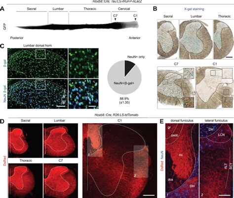 Characterization Of Hoxb Cre Expression In The Spinal Cord A