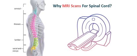 Decoding Spinal Cord MRI: A Patient Guide | Ganesh Diagnostic