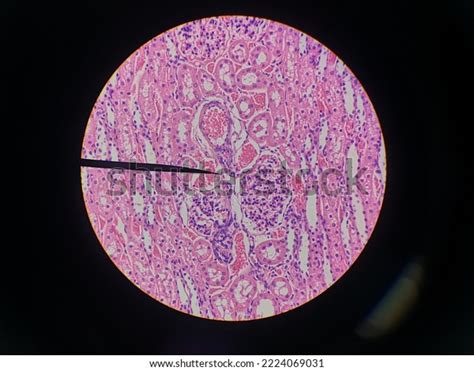 Picture Histology Show Epithelium Cell Microscope Stock Photo 2224069031 | Shutterstock