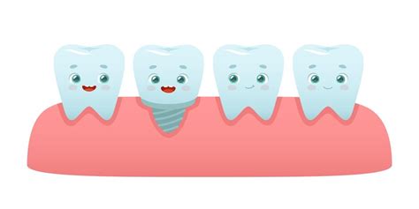 Fila De Dientes Con Implante Tratamiento De Ortodoncia De Dientes De