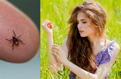 How To Identify And Protect Yourself Against Lyme Disease [video]