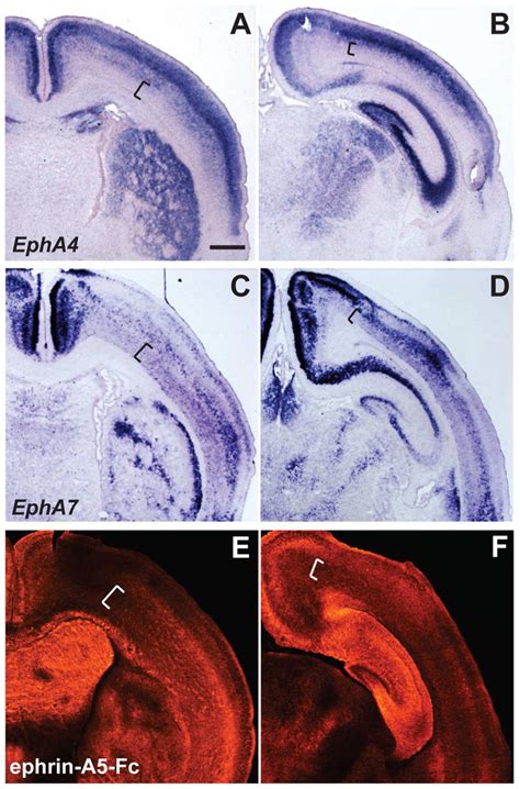 Distinct Expression Patterns Of EphA4 And EphA7 In Comparison To