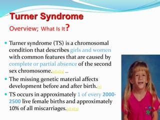 Turner syndrome | PPT