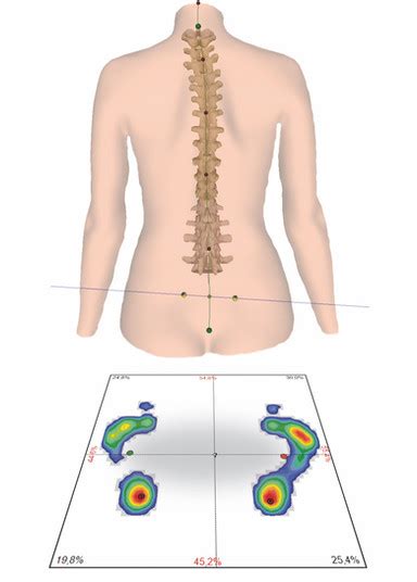 Osteopathie Heilpraktikerin Maike Balk Elmshorn