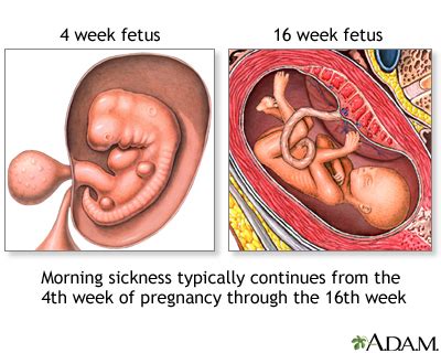 Is Retching A Sign Of Pregnancy