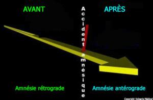 Amn Sie R Trograde Et Amn Sie Ant Rograde Anatomie Photo Et Illustration