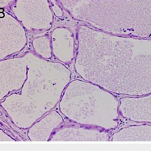 Photomicrographs Of H E And Immunohistochemical Stained Specimens