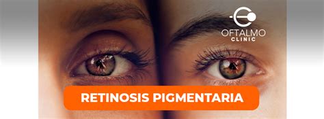 RETINOSIS PIGMENTARIA Oftalmoclinic