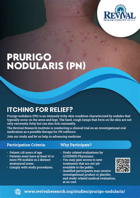 Prurigo Nodularis Clinical Trials