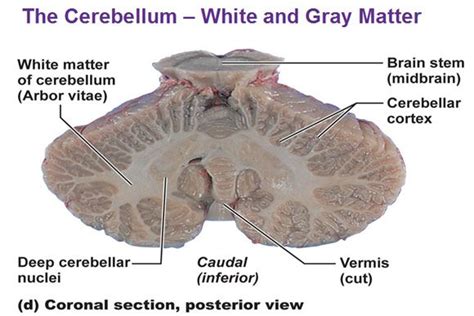 The Cerebellum Coronal Section Posterior View Of White And Gray Matter