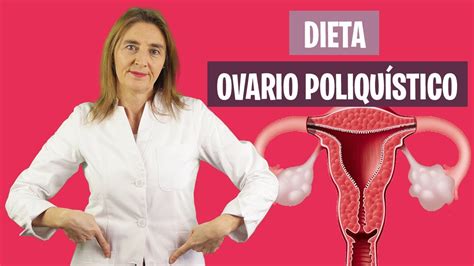 TRATAMIENTO DIETÉTICO para OVARIO POLIQUÍSTICO Dieta ovario