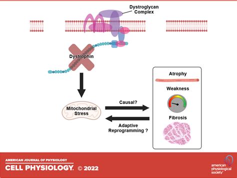 Duchenne Muscular Dystrophy Diagram