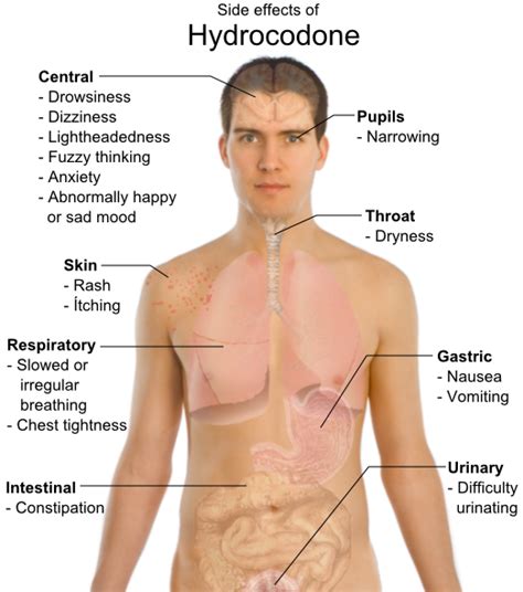 Side effects of Hydrocodone - Blog2Best