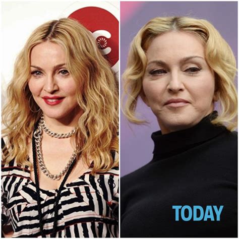 Madonna irriconoscibile a Londra: troppo botox per la stampa inglese