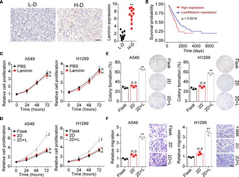 Frontiers Laminin Bound Integrin α6β4 Promotes Non Small Cell Lung