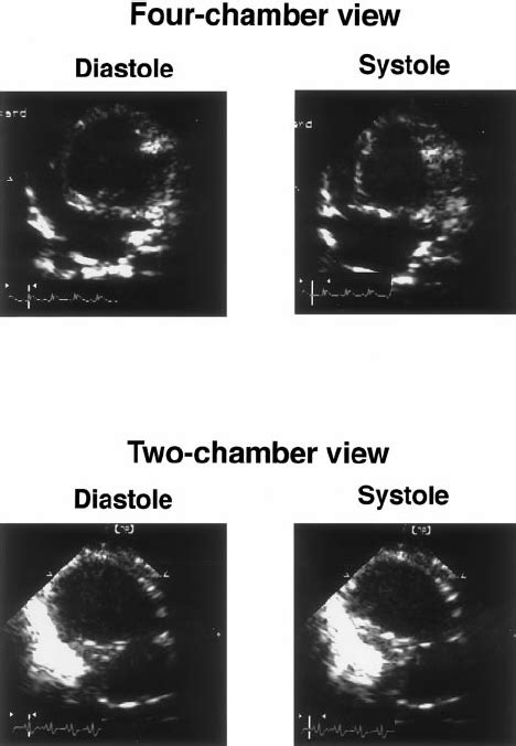 Two Dimensional Echocardiograms Apical View From Rats Weeks After