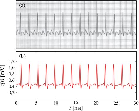 Scielo Brasil Modelo Matem Tico Para A Reprodu O De Sinais De Ecg