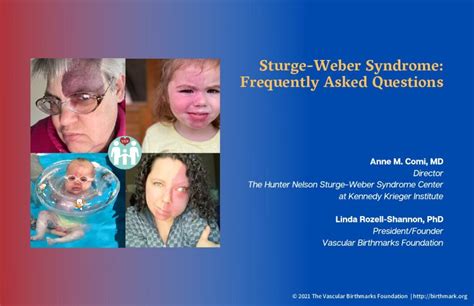 Sturge-Weber Syndrome - Vascular Birthmarks Foundation