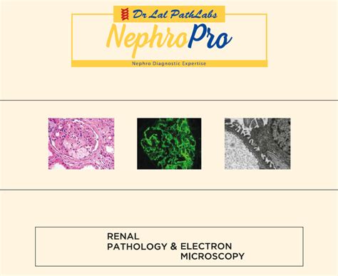 Renal Pathology And Electron Microscopy Dr Lal Pathlabs Blog