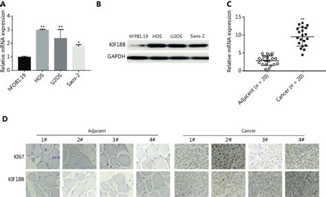 Kif B Is Overexpressed In Osteosarcoma Tissues And Cells A Mrna And