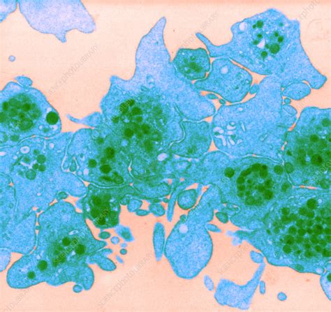 Aggregating Platelets TEM Stock Image C022 0096 Science Photo